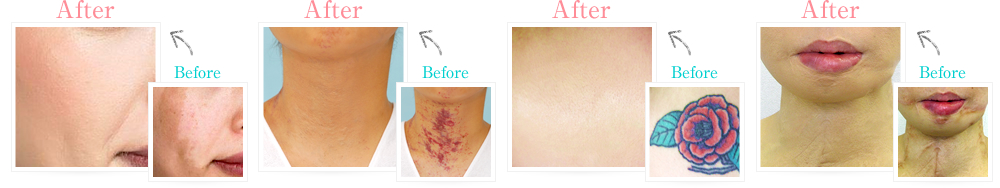 Before & After